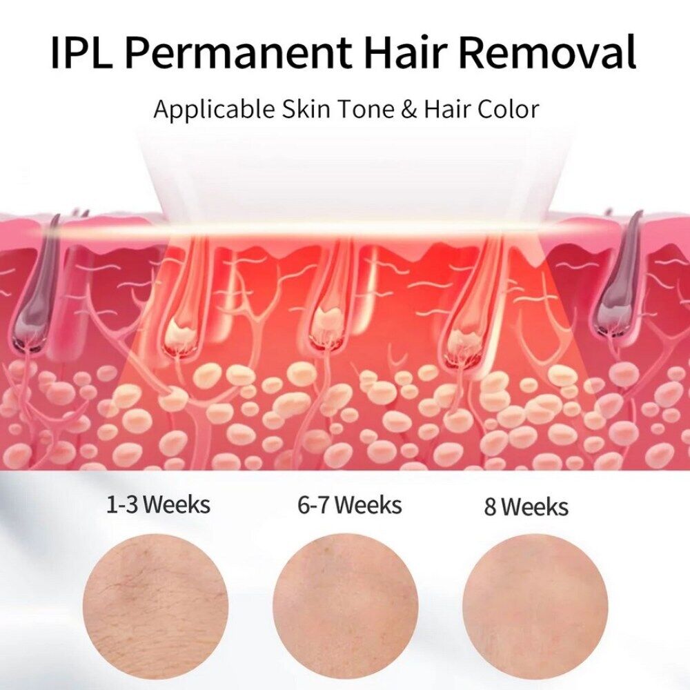 IPL Hair Removal Laser